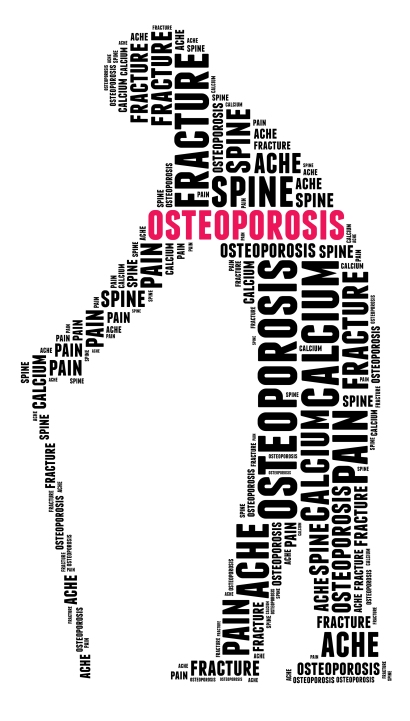osteoporosis-facts-symptoms-treatment
