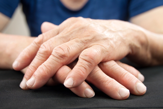 relieving-arthritis-pain-in-hands